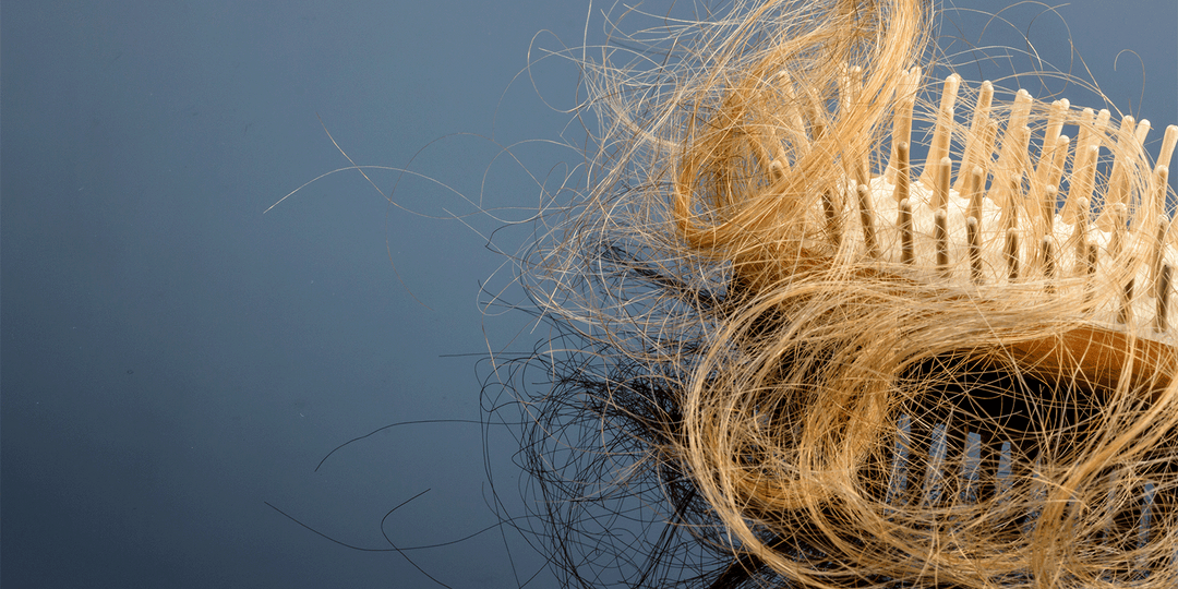 The Connection: Hair Loss and Weight Loss