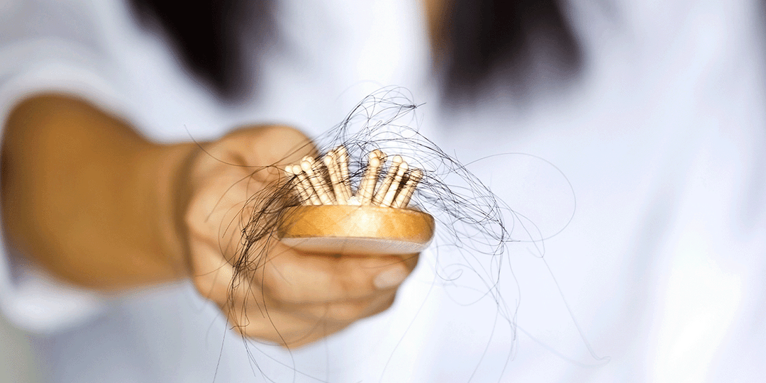 Hair Loss – Will It Happen to Me?